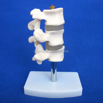 Geavanceerde PVC-educatieve modellen Cutaway Osteoporose van de wervelkolom Lezingen van de lumbale wervel