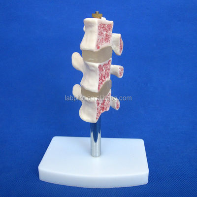 Geavanceerde PVC-educatieve modellen Cutaway Osteoporose van de wervelkolom Lezingen van de lumbale wervel