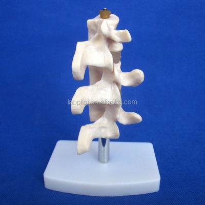 Geavanceerde PVC-educatieve modellen Cutaway Osteoporose van de wervelkolom Lezingen van de lumbale wervel