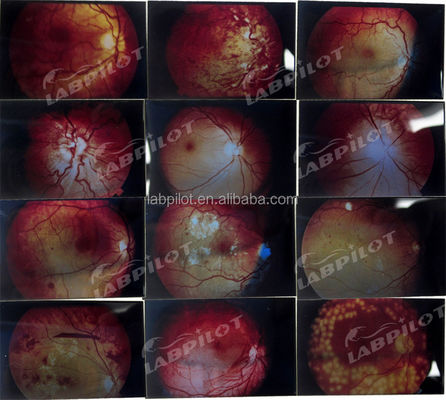 Mannequin voor geavanceerd menselijk oogonderzoek Training Simulator Retinopathie Fundus Model