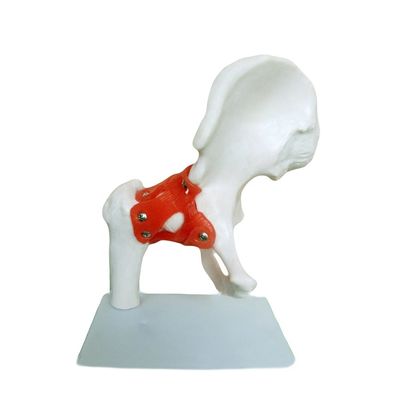 Gedetailleerde anatomische structuren Medisch onderwijs Heupgewricht model met kunstmatige ligamenten menselijk bot