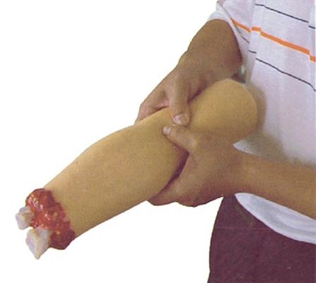 Traumaverpleegkunde Model Armamputatie en hemostase voor wondbehandeling van bovenste ledematen