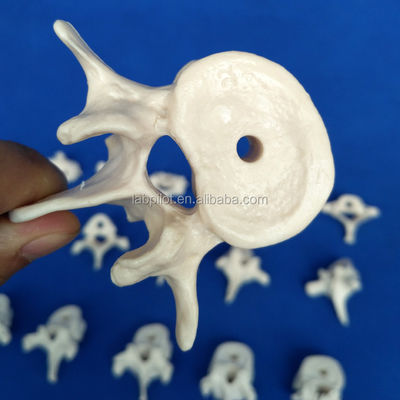 Levendige wervelmodellen voor de medische wetenschap Cervicale thoracale lumbale sacrum en Coccyx