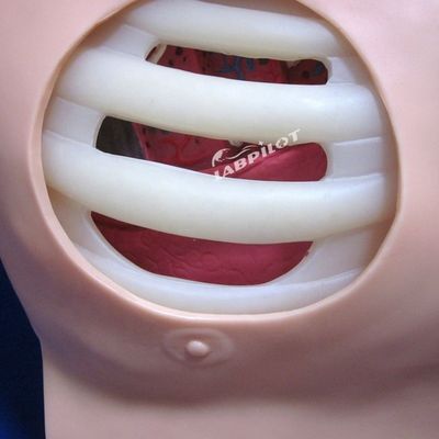Geavanceerde PVC-pop voor verpleegkundige opleiding in pleurale punctie, drainage en thoracentesis