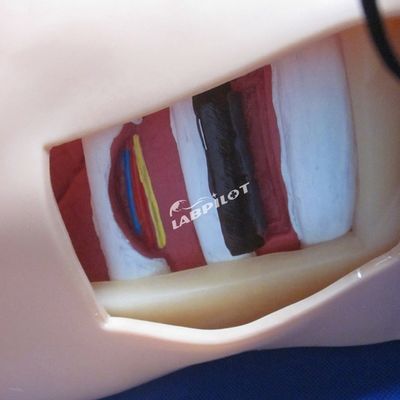 Geavanceerde PVC-pop voor verpleegkundige opleiding in pleurale punctie, drainage en thoracentesis