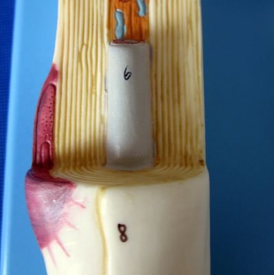 Geavanceerd PVC-anatomisch model van vergroot neuronale cellichaam en zenuwvezelstructuur