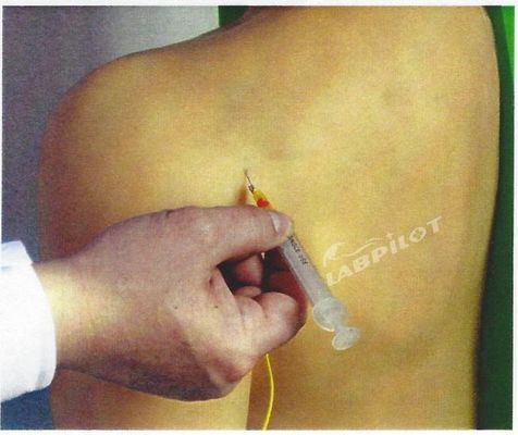 Geavanceerde PVC medische opleiding Schoudergewricht Intracavitary Injection Simulator Onderwijsmodel