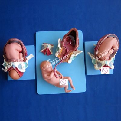 Medisch anatomisch demonstratie model bevalling bekken en volle term foetus model