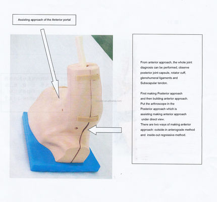 Vivid Shoulder Joint Anatomy Training Model met afneembare schouderartroscopie simulator