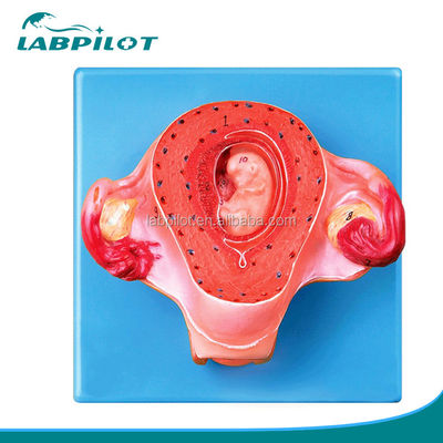 Geavanceerd PVC baarmoedermodel voor de tweede maand van de zwangerschap Anatomische baarmoederdemonstratie