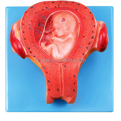 Gevorderd PVC Item Zwangere embryo model Derde maand Uterus met navelstreng model