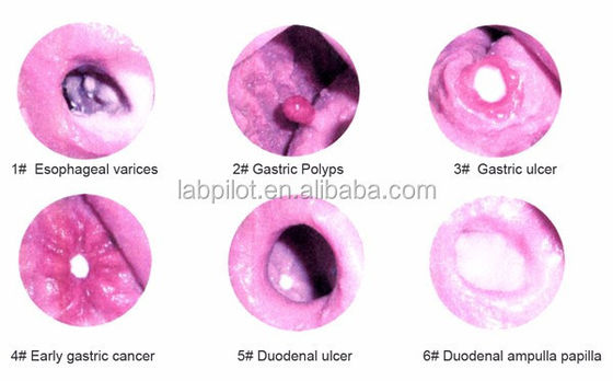 Geavanceerd gastroscopisch onderzoek en ERCP-trainingsmodel voor gastro-intestinale laesies