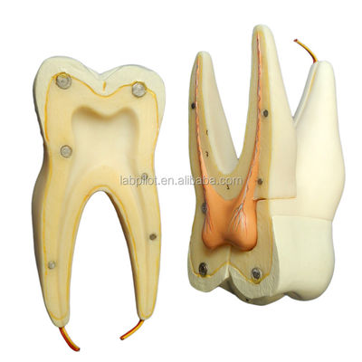 Demonstratie tandheelkundige verzorging Afneembare anatomische tanden model voor drie-wortel molar tanden