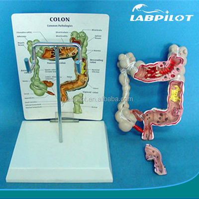 Ophthalmologische anatomische modellen Mensendarmmodel voor darm- en rectumziekten