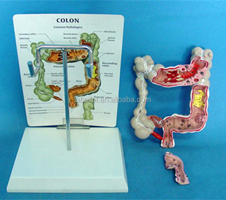 Ophthalmologische anatomische modellen Mensendarmmodel voor darm- en rectumziekten