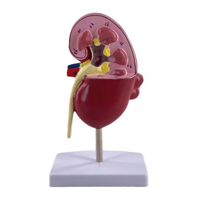 PVC-patologisch niermodel voor medische scholen en urologische ziekenhuizen Demonstratie