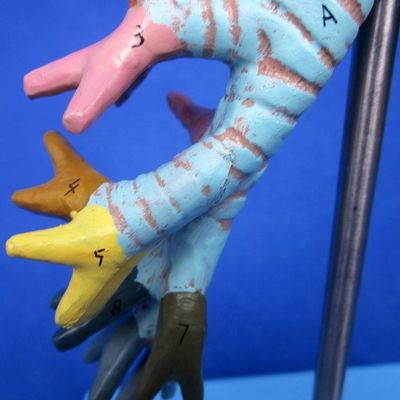 Medische wetenschappen Display Afneembare bronchiale boom en luchtpijpmodel voor larynx anatomie