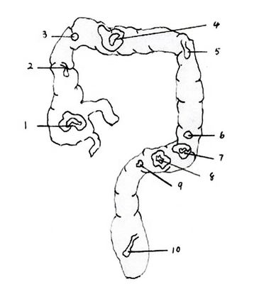Rectum en Colon Anatomie Model Geavanceerde PVC Human Life Size Intestinal Endoscopy Simulator