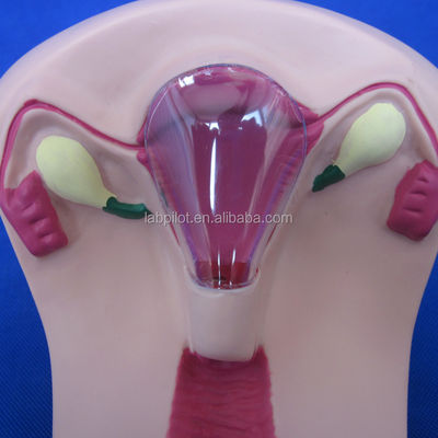 PVC-IUD-contraceptiemimulator Het ideale onderwijsinstrument voor gezinsplanning