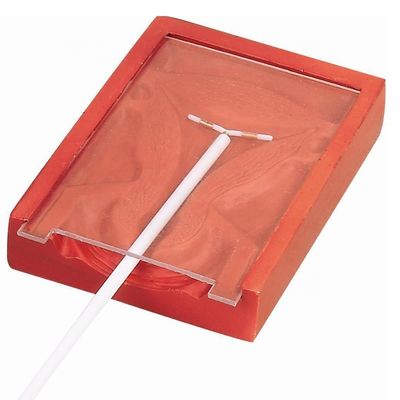 Verloskunde en gynaecoloog Vaardigheden onderwijzen IUD-inbreng Trainer voor patiëntenzorg