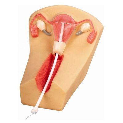 PVC-IUD-contraceptiemimulator Het ideale onderwijsinstrument voor gezinsplanning